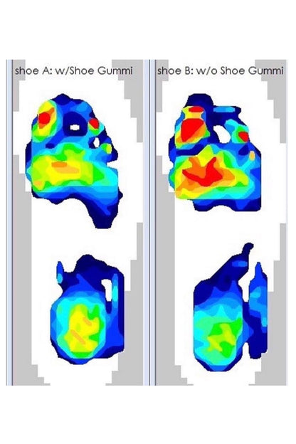 SHOE GUMMI (ROUNDED)